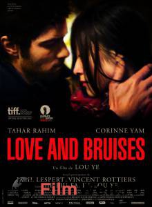      Love and Bruises 
